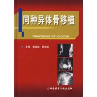 同种异体骨移植