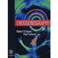 内镜超声学：Endosonography