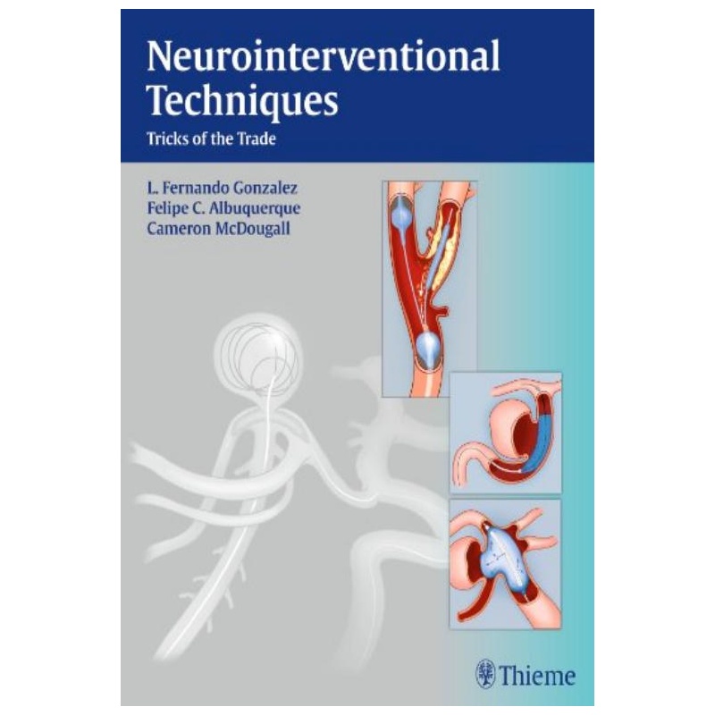 《英文原版Neurointerventional Techniques: Tri