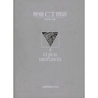 肝癌CT图谱