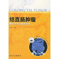 结直肠肿瘤