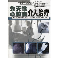 先天性心脏病介入治疗