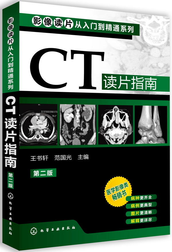 CT读片指南-第二版 \/王书轩,王书轩-图书杂志-医