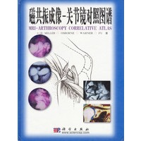 磁共振成像——关节镜对照图谱