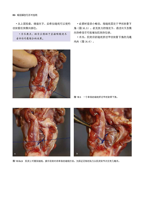 喉部解剖与手术指南